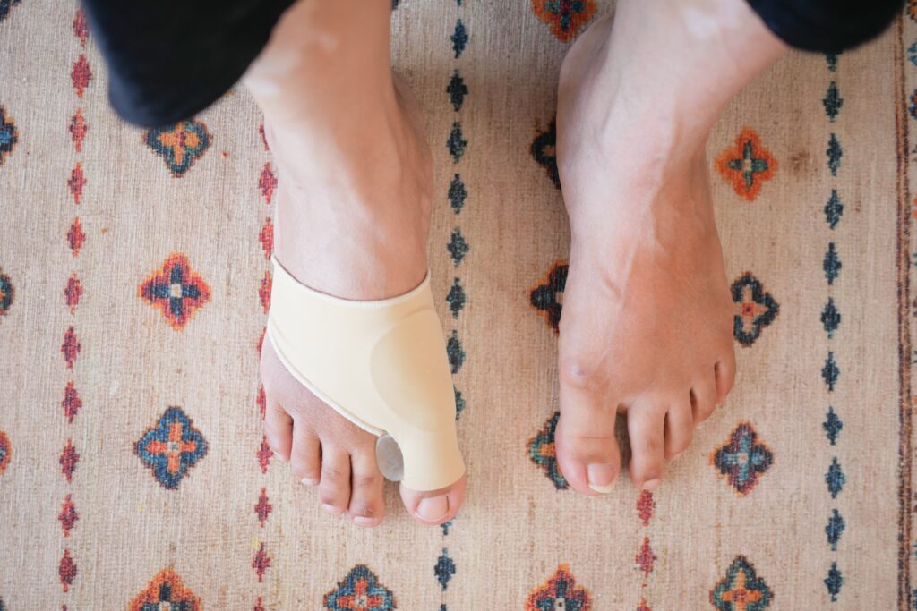 Bunion Pain: What Your Feet Are Telling You